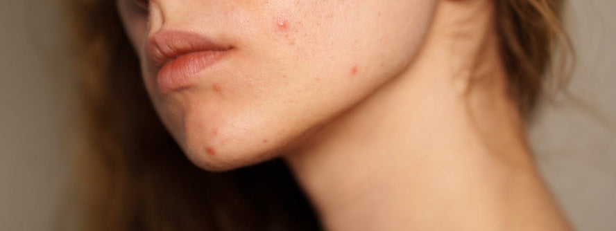 Person with problem skin