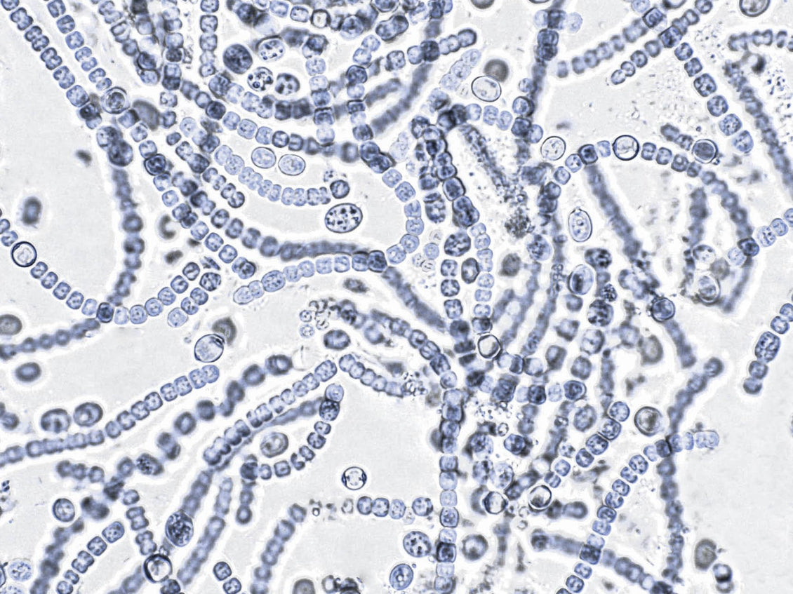 Microscopic view of fungal hyphae and spores under a microscope